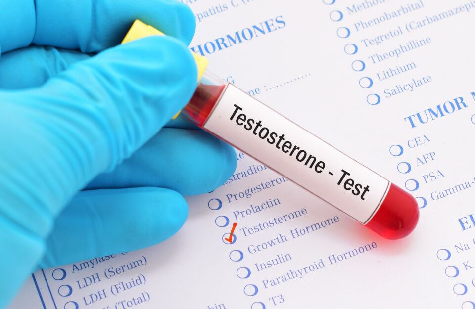 Examen de Testosterona
